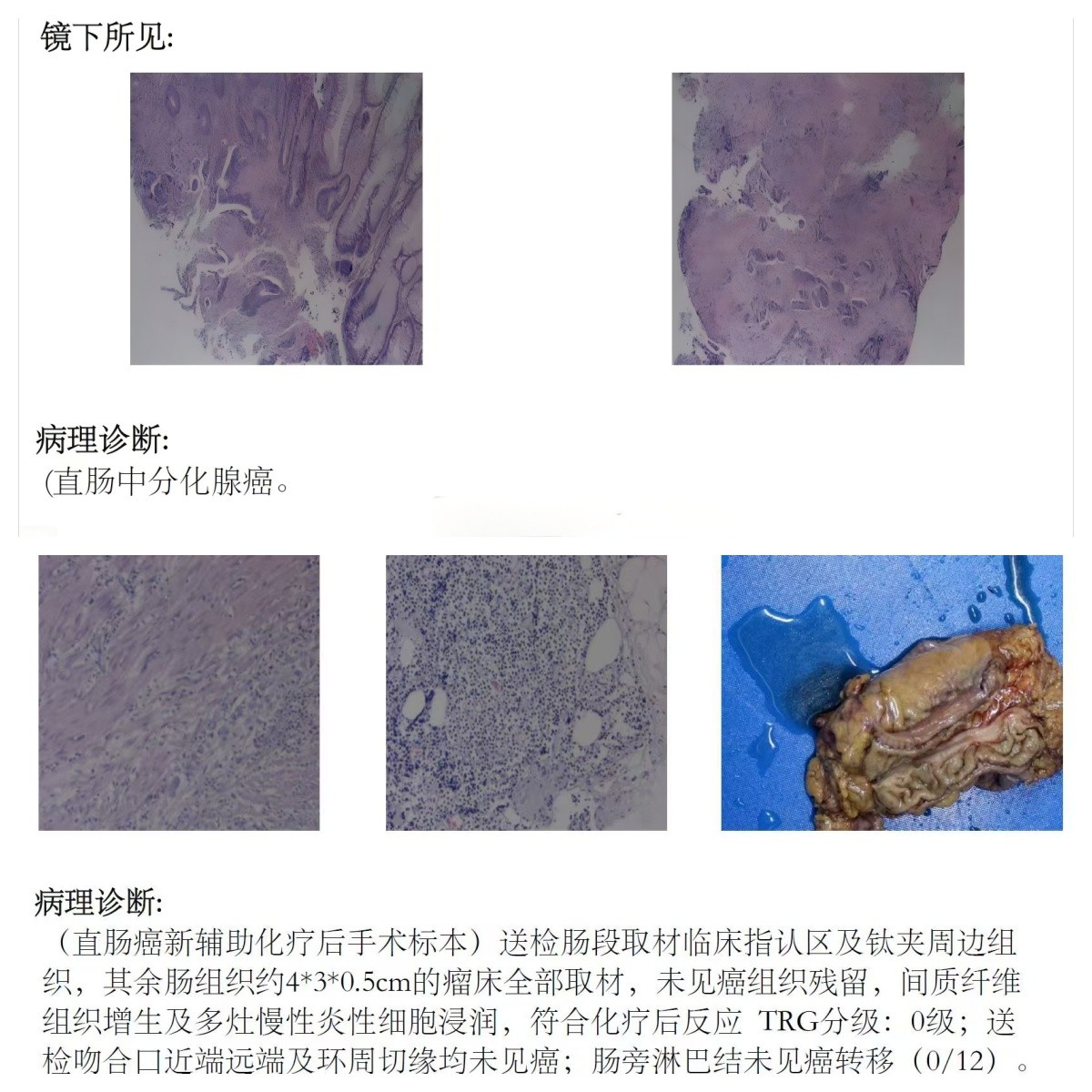 化疗前后对比.jpg 化疗前后对比.jpg